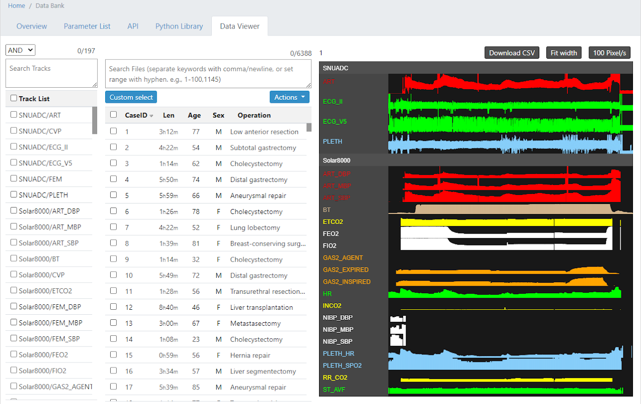 VitalDB web screen