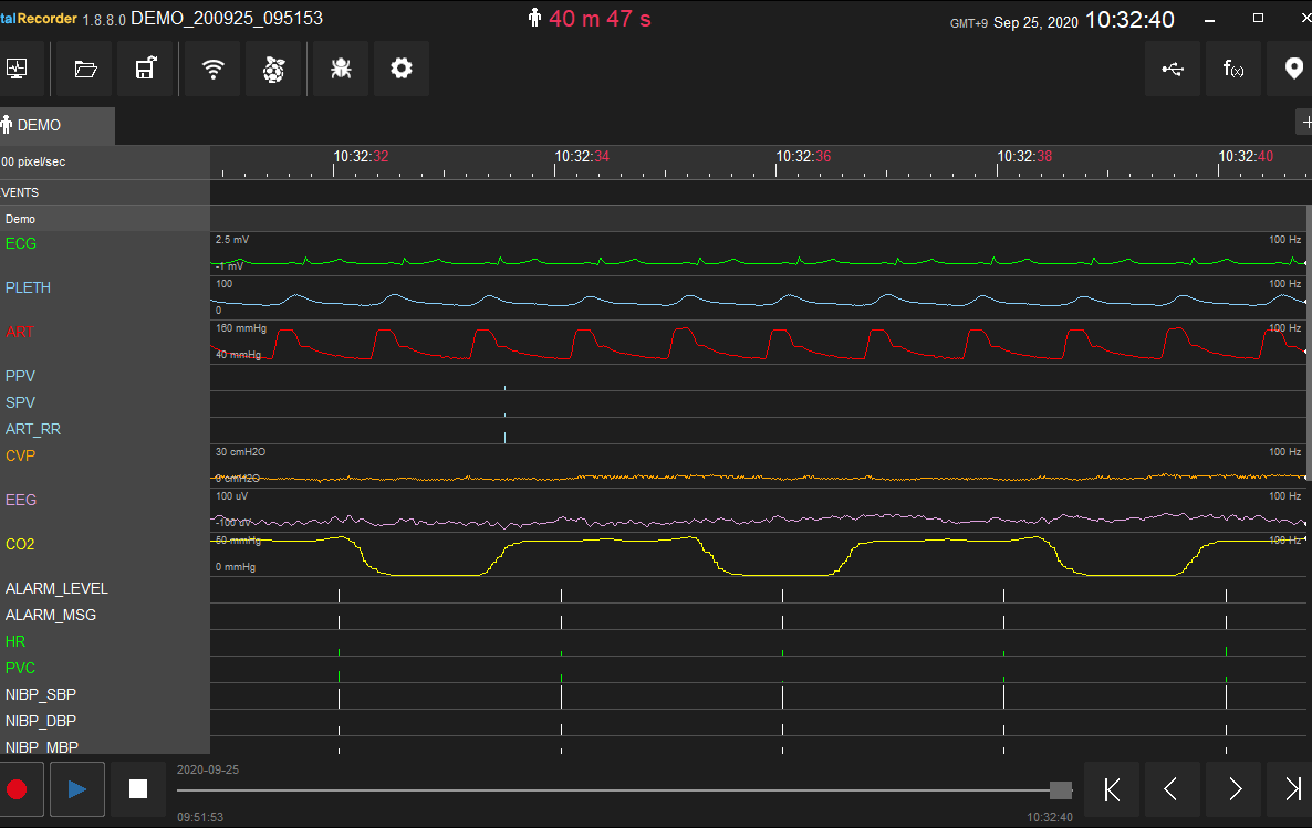 VitalRecorder screen