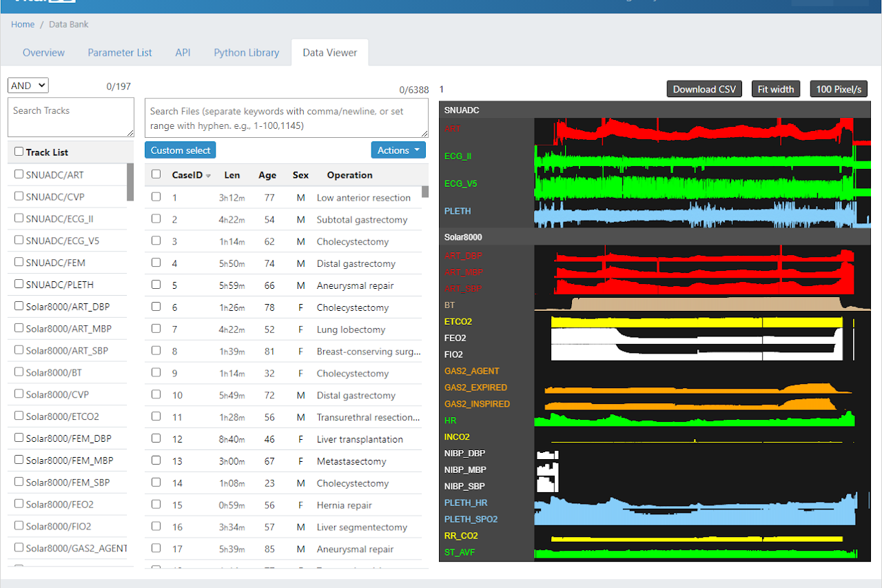 VitalDB web monitoring