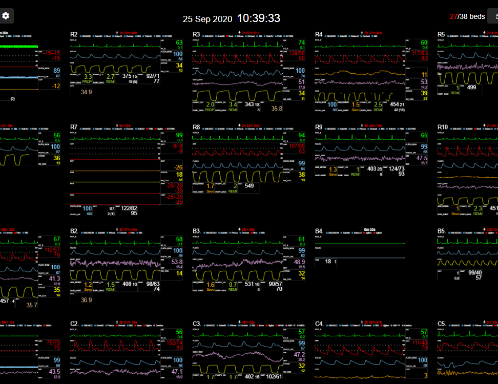 VitalRecorder recording biosignals